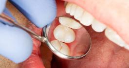 Other Dental Treatments